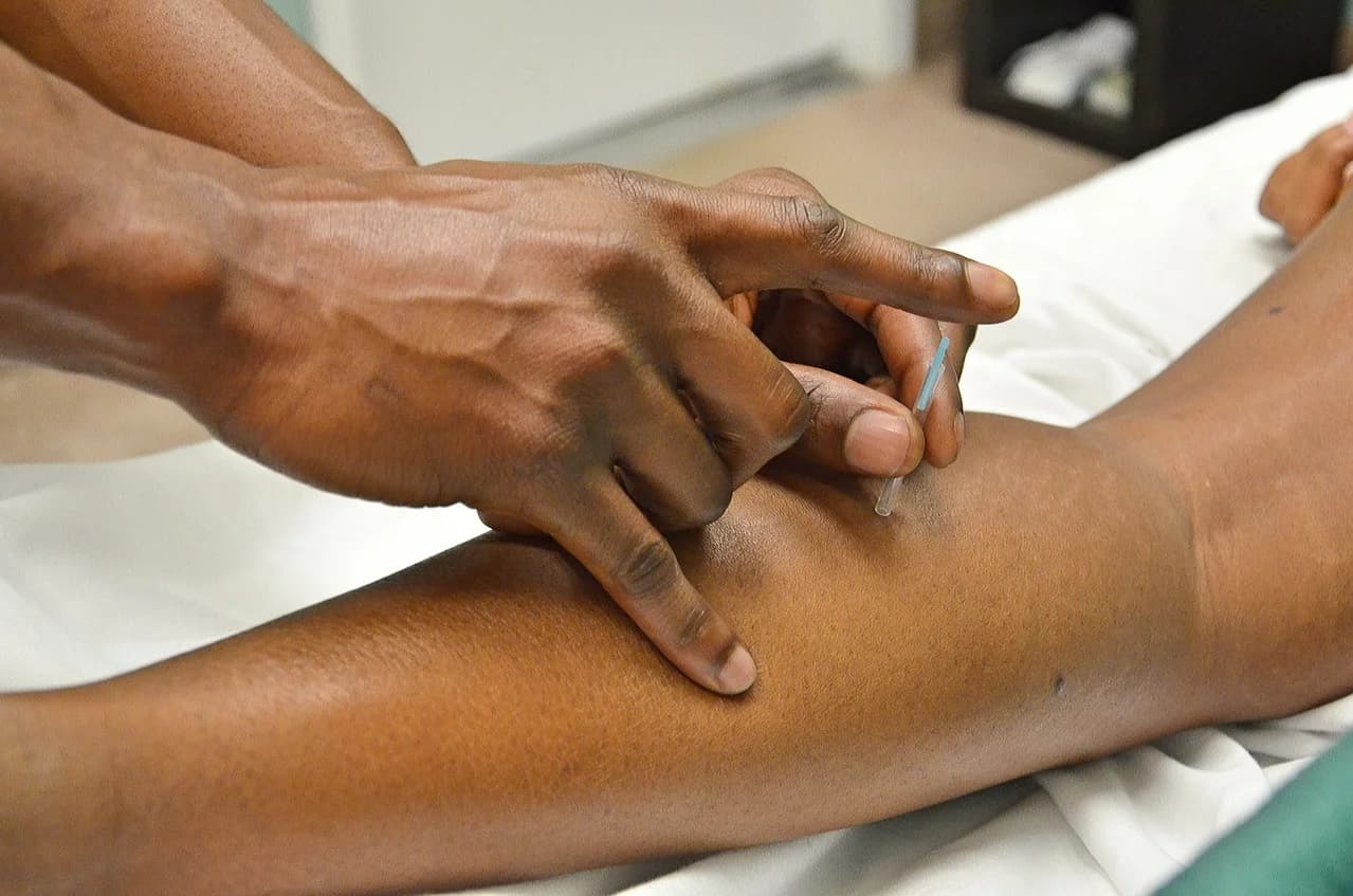 Trigger Point Therapy and Acupuncture - Podiatry health article from FALL Clinic Perth