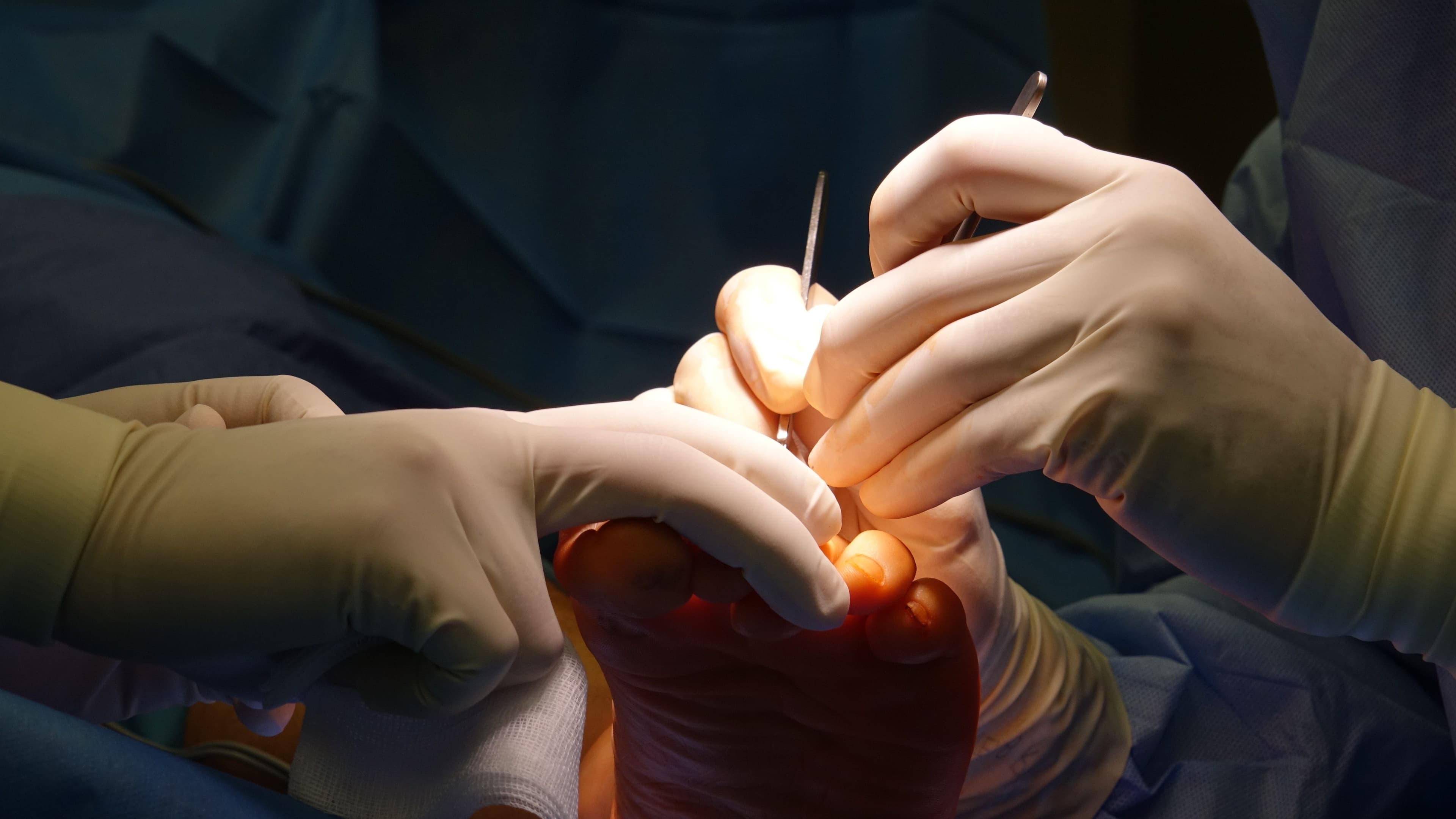 What is a Ganglion?
