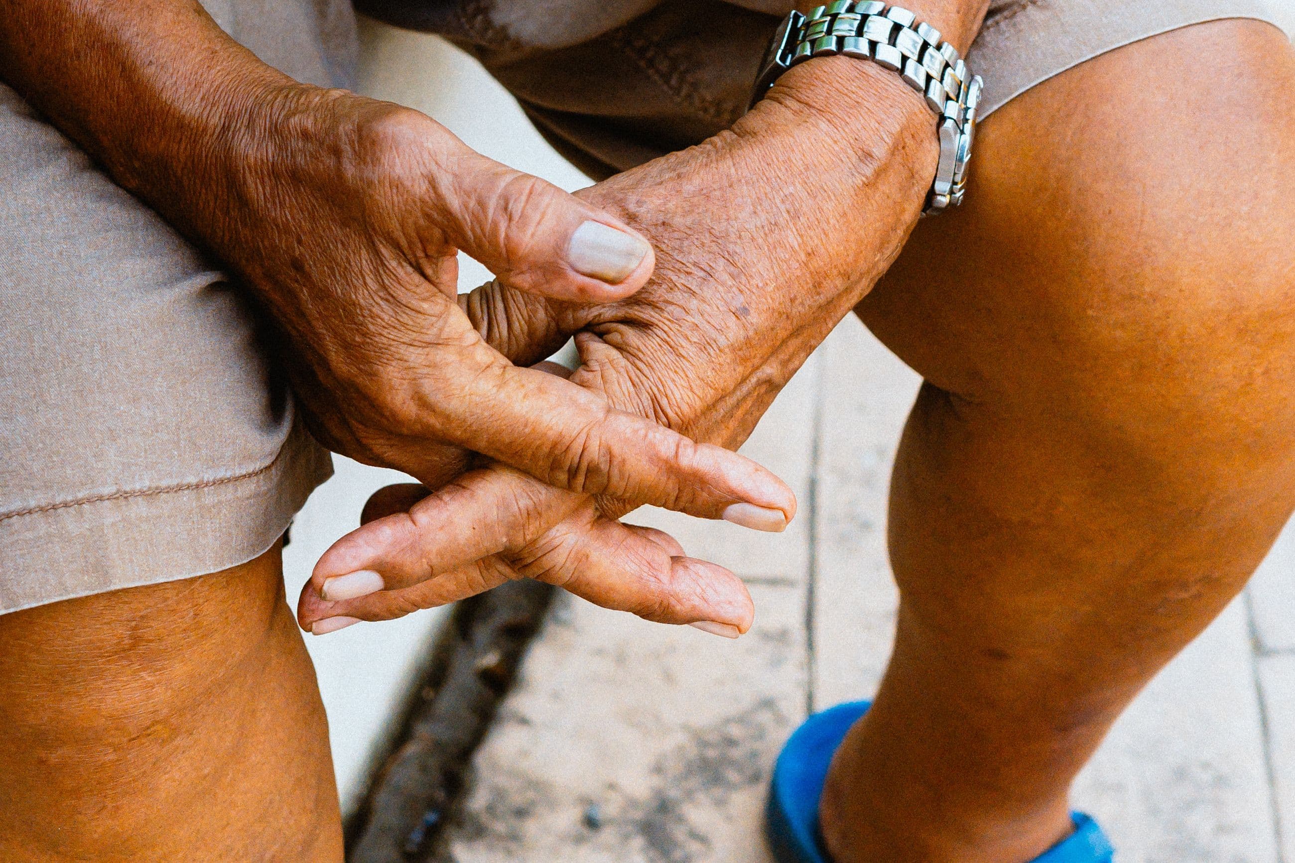 Ageing Skin